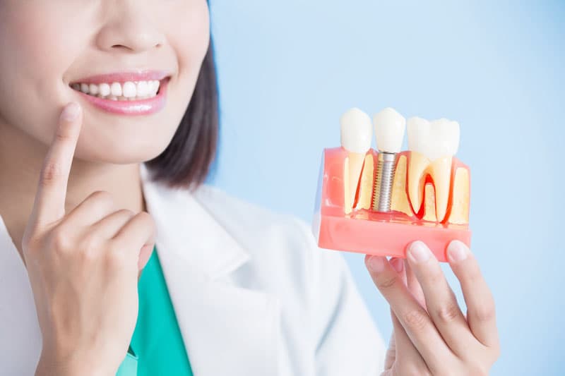 Implante de dientes