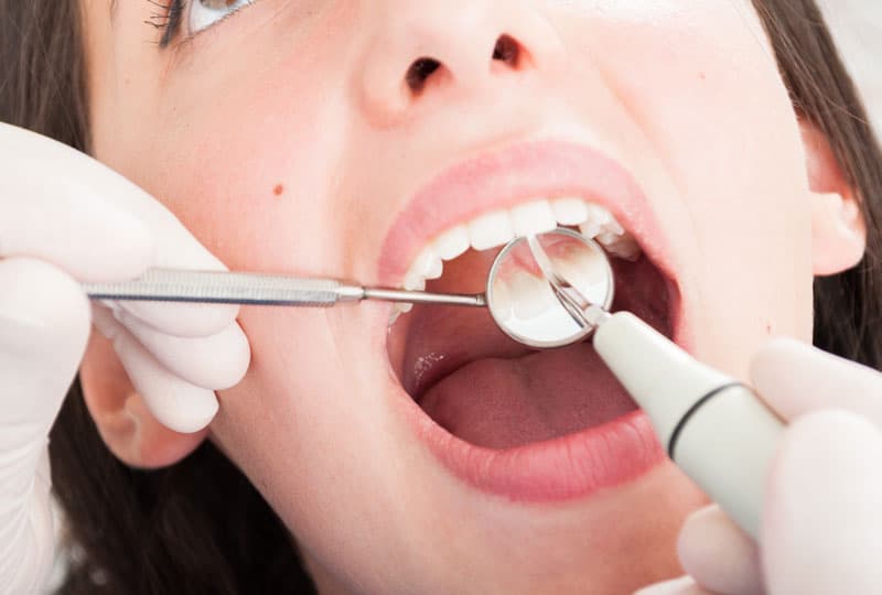 Endodoncia en a coruña