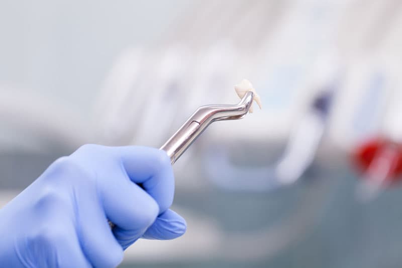 Estética dental en a coruña